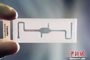 全國320萬新生兒接受遺傳性耳聾基因篩查 軟件開發的關鍵作用與現代應用